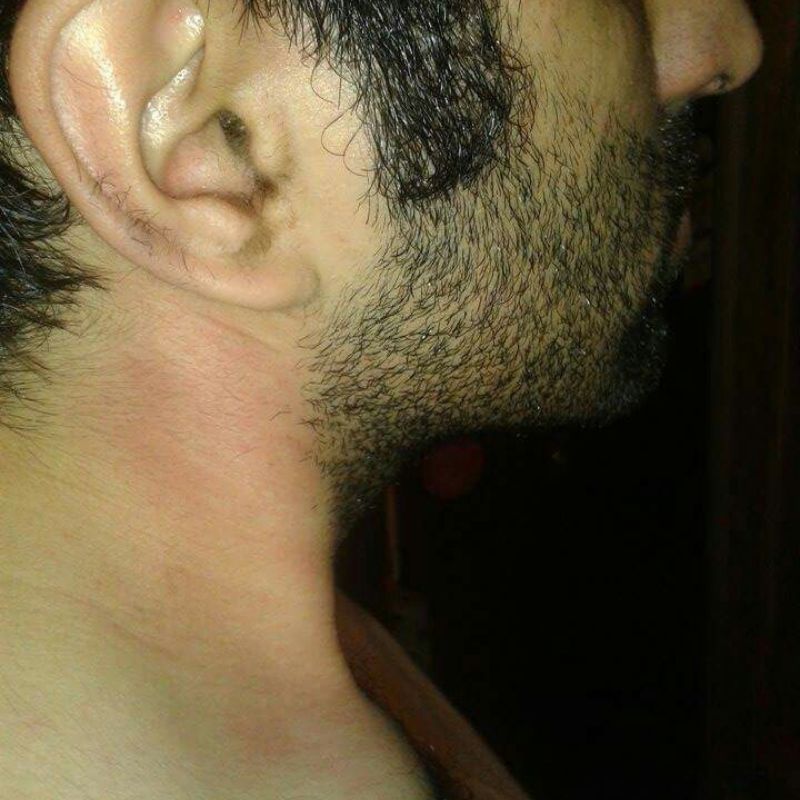 Restoring Flexibility Physio Centre by Dr. Aditya, a Physiotherapist in Bandra